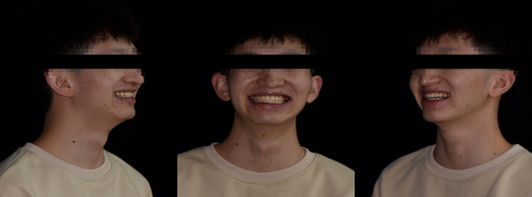 1691572128825177.png